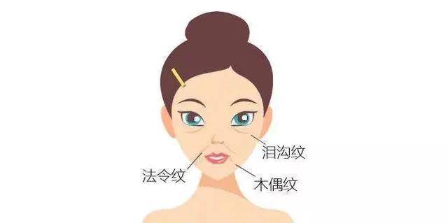 什么样的人容易产生"三八纹"呢?
