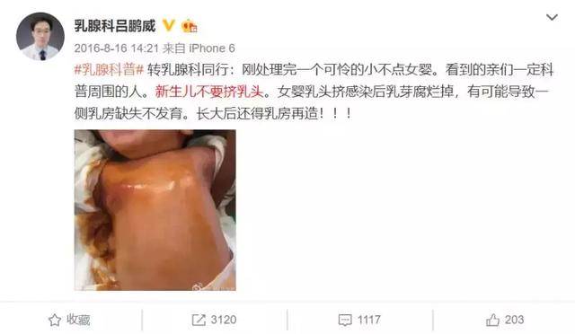 #宝宝#只因奶奶太疼爱!这6大育儿坑,简直坑坑要命!婴儿差点截肢