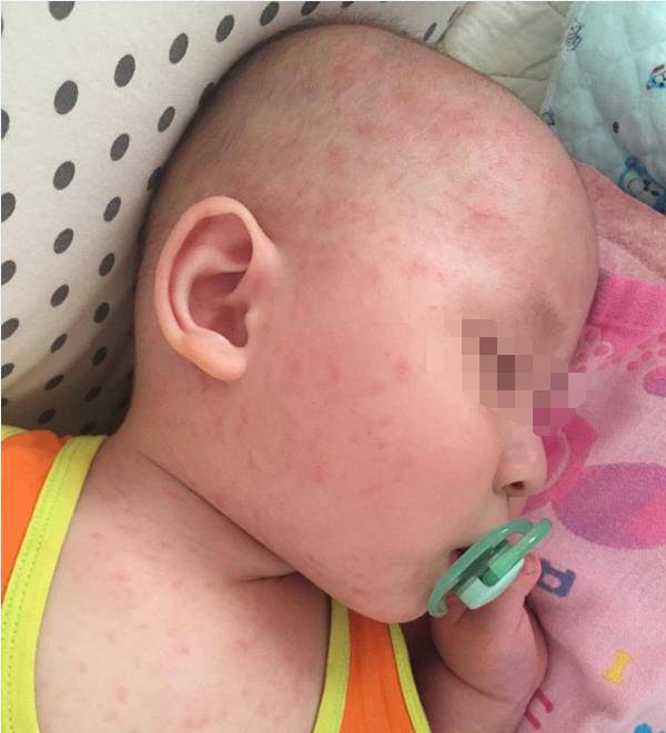 八个月宝宝发烧38度怎么退烧最快 220ac07d2bda474092aecd0b87b771a5.jpeg