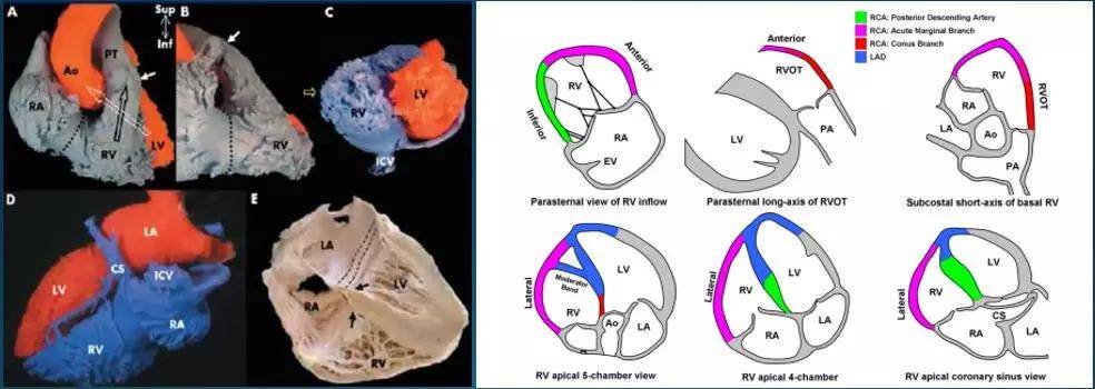 超声心动图十大基本功6.1:右心室解剖特点_功能