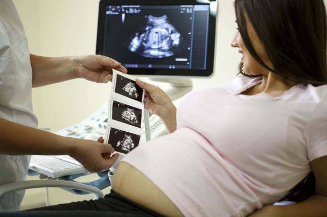 B超产检时，有心医生会说“暗语”暗示宝宝性别，孕妈听懂了吗？