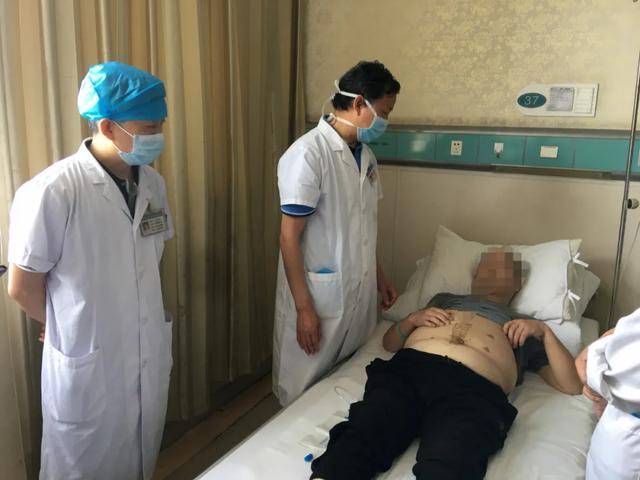 胆囊息肉转癌危及生命，纳米刀下获新生