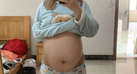 nt■为何会查出胎儿畸形？孕妈妈应该了解nt查出胎儿唇裂