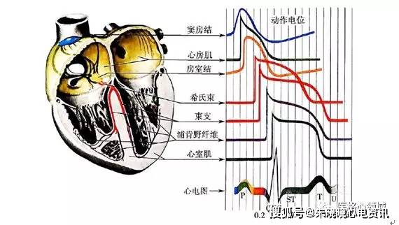 正常心电图波形及临床意义_心室