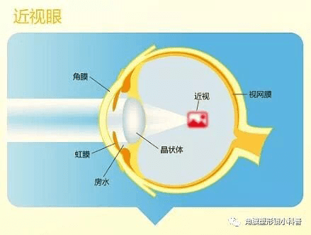 8d82e775ff394f02afe212877b2a2913.png