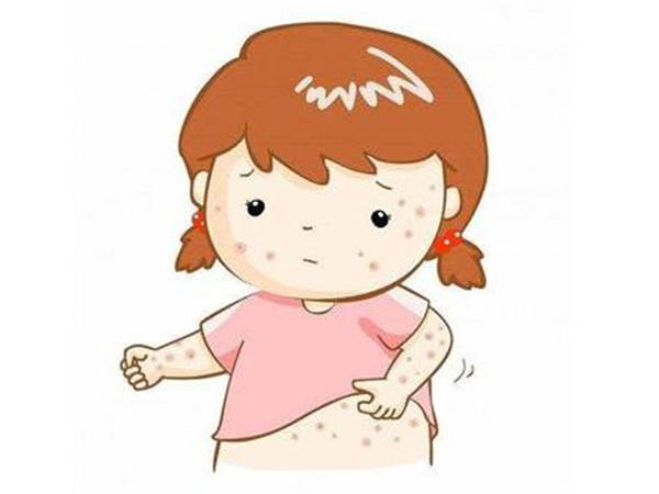 宝宝|宝宝夏季热痱困扰你？清爽一夏的秘诀来了！