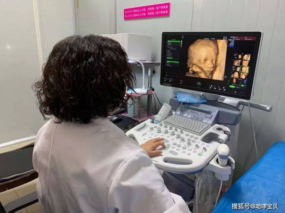 单胎和双胞胎检查时间不同数据详解四维彩超孕妈更安心