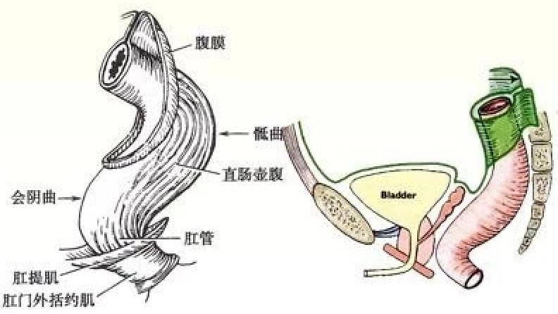 一条罗非鱼"游"进肛门?医生:直肠不直,进去容易出来难