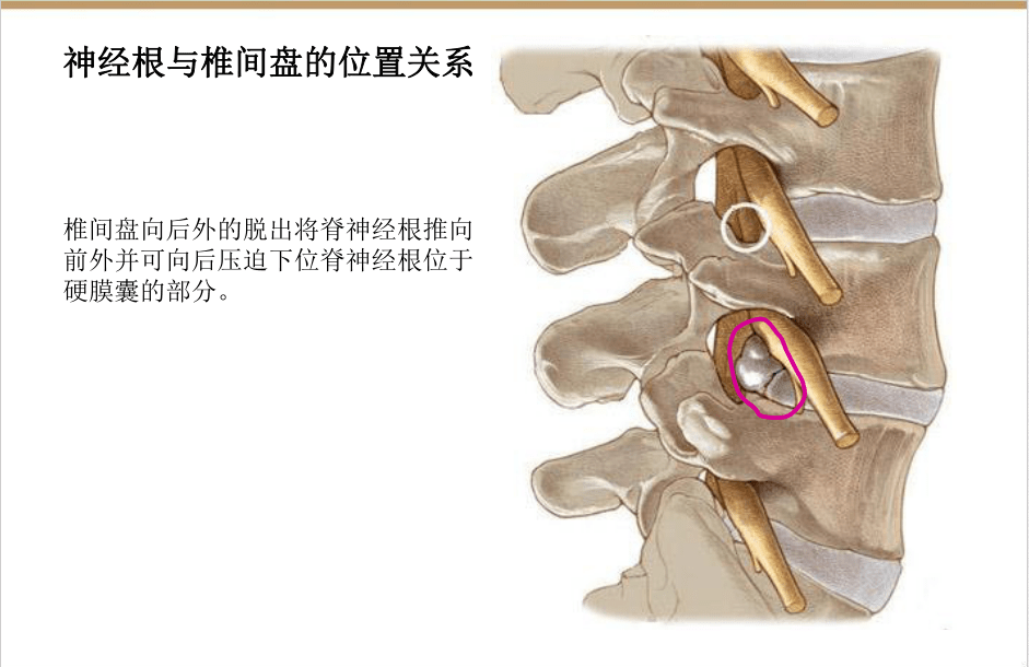 【收藏版】椎间孔镜技术脊柱应用解剖图表