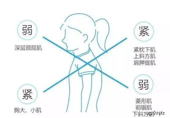 上交叉综合征训练方法,解决圆肩及驼背的烦恼