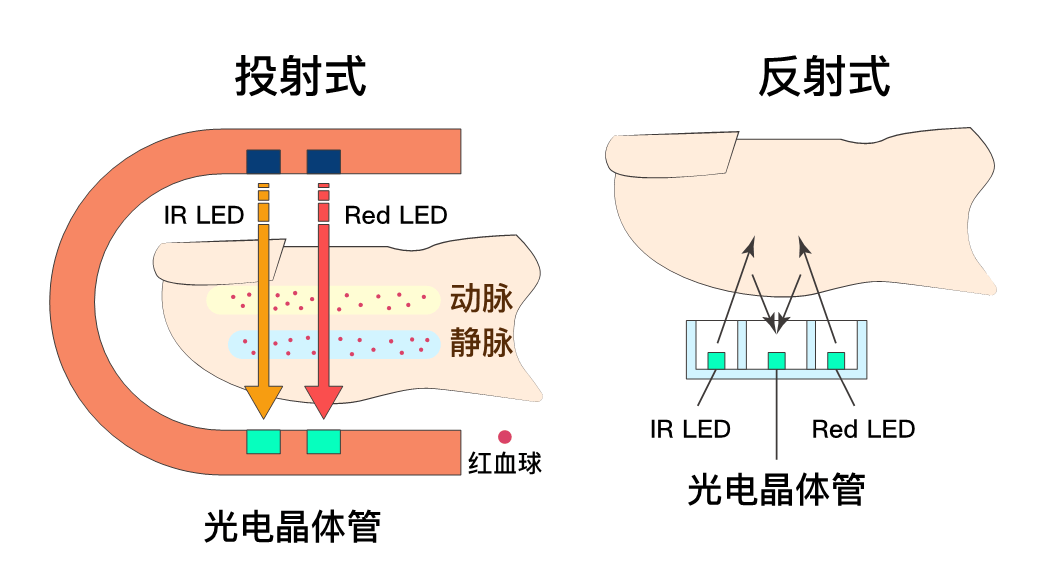 手环监测睡眠的原理是什么_睡眠监测手环分解图