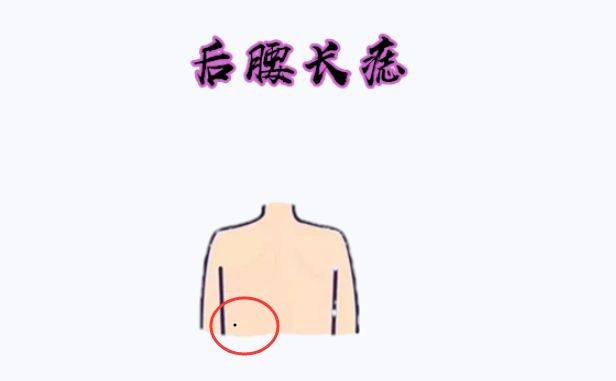 后腰长痣在相学当中,若是在后腰的位置处长有吉痣,有"腰缠万贯"的说法