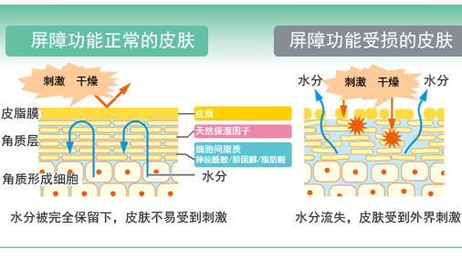 你的肌肤屏障足够坚固吗?_皮肤