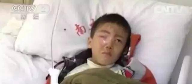 眼球|家长千万要警惕！20分钟孩子眼球被溶化！这东西每家都有
