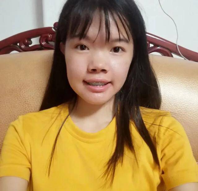 公认的5种"丑鼻型,一鼻毁了整张脸,颜值再高也拯救不了