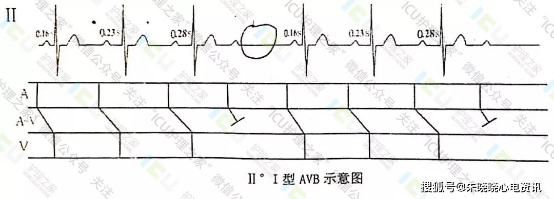 心电图这样读图,没有不会的!