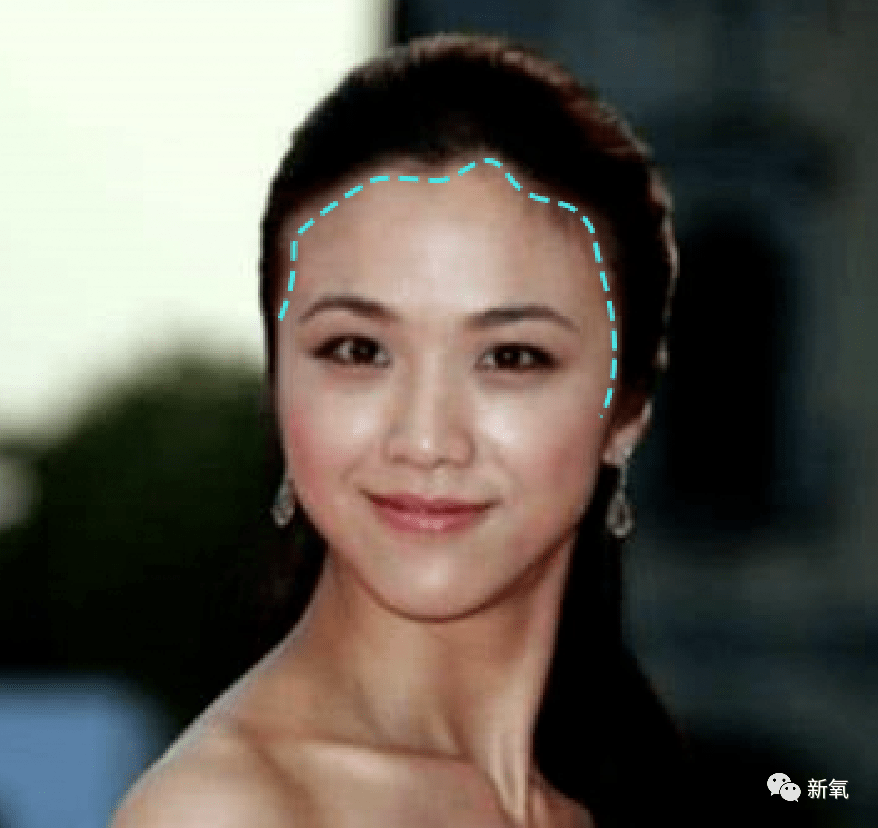 虞书欣不是才24岁吗?怎么就秃成这样了…