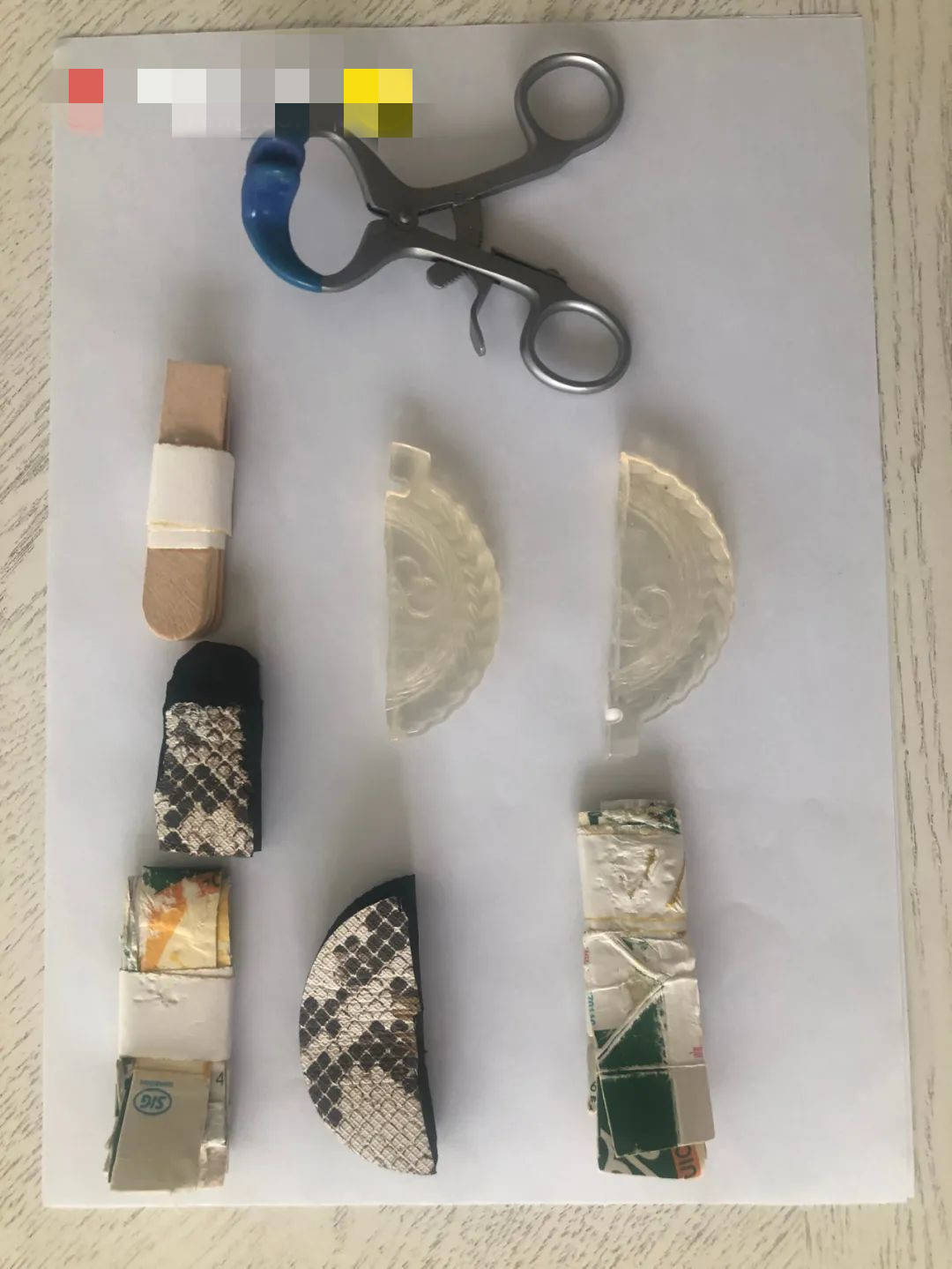 最美女明星皮肤溃烂手指发黑，放下性感包袱往