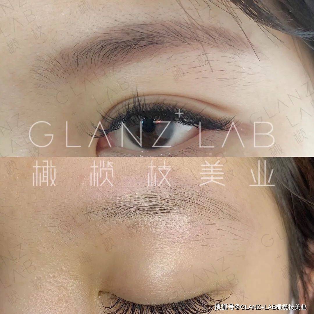 来了解下火爆市场的顶级黑科技无创洗眉技术吧|glanzxlab橄榄枝美业