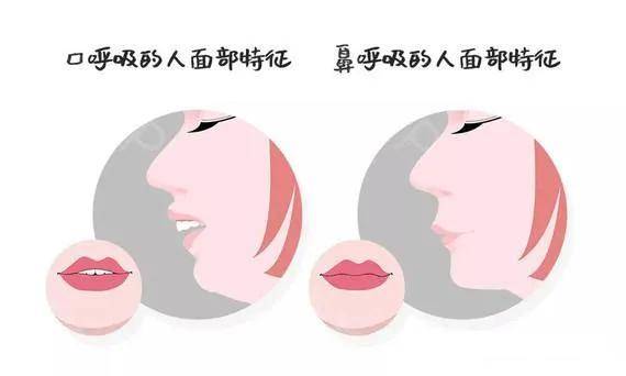 牙什么嘴成语_成语故事简笔画(3)