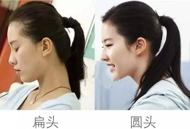 原创圆头扁头到底谁更好看?看到这对龙凤胎以后,你就有答案了