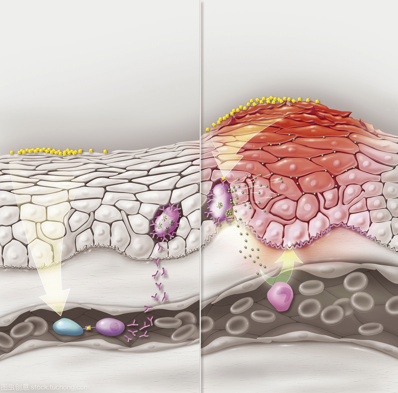 细胞受损后的皮肤表现示意图