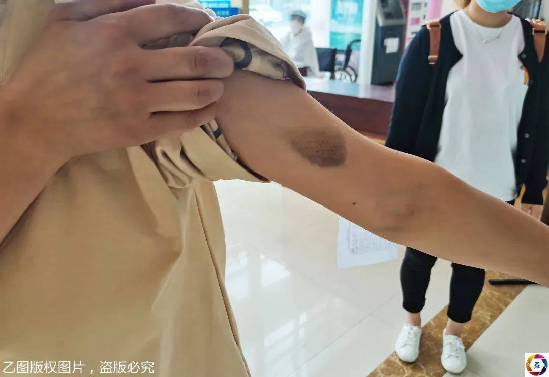 爸爸|花季少女的自白：9年来常遭继父酒后施暴，13岁时又一个噩梦降临