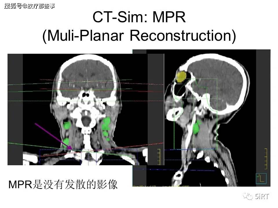 ct模拟定位系统的质量保证