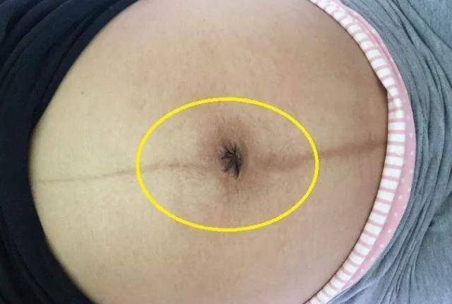 原创怀孕期间,肚子里是男孩还是女孩?这4种症状帮你判断,建议收藏