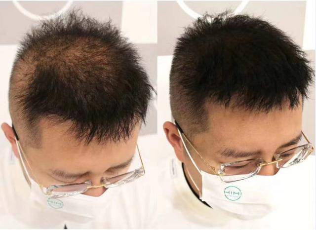 这是纹发之后的效果