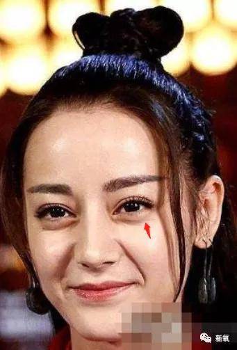 张脸|当年艳绝四方让张雨绮都甘心做配,可现在这张脸说崩就崩了...