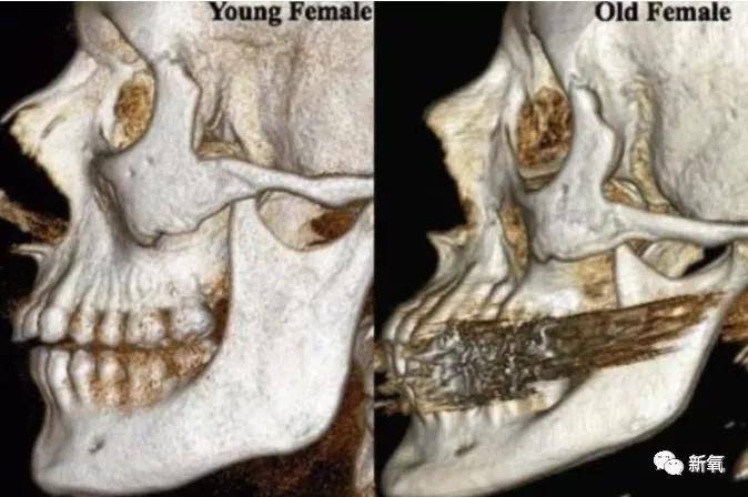 张脸|当年艳绝四方让张雨绮都甘心做配,可现在这张脸说崩就崩了...