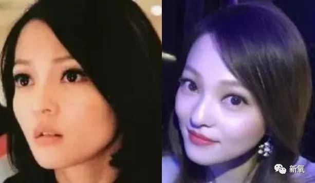 张脸|当年艳绝四方让张雨绮都甘心做配,可现在这张脸说崩就崩了...