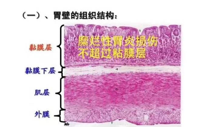 一般来说,身体胃壁的结构是由内向外依次分成的,一般是由粘膜层,粘膜