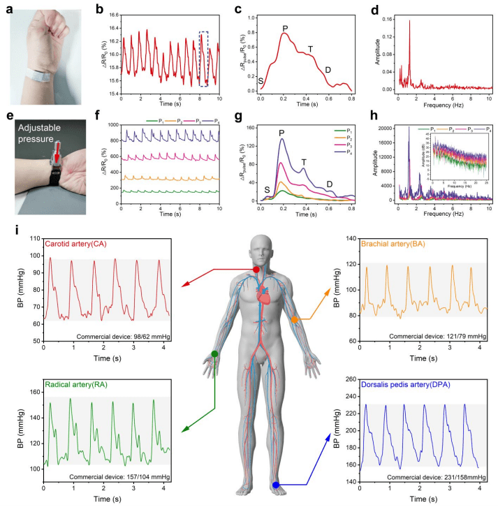图2-tmpgps用于动脉脉搏检测.