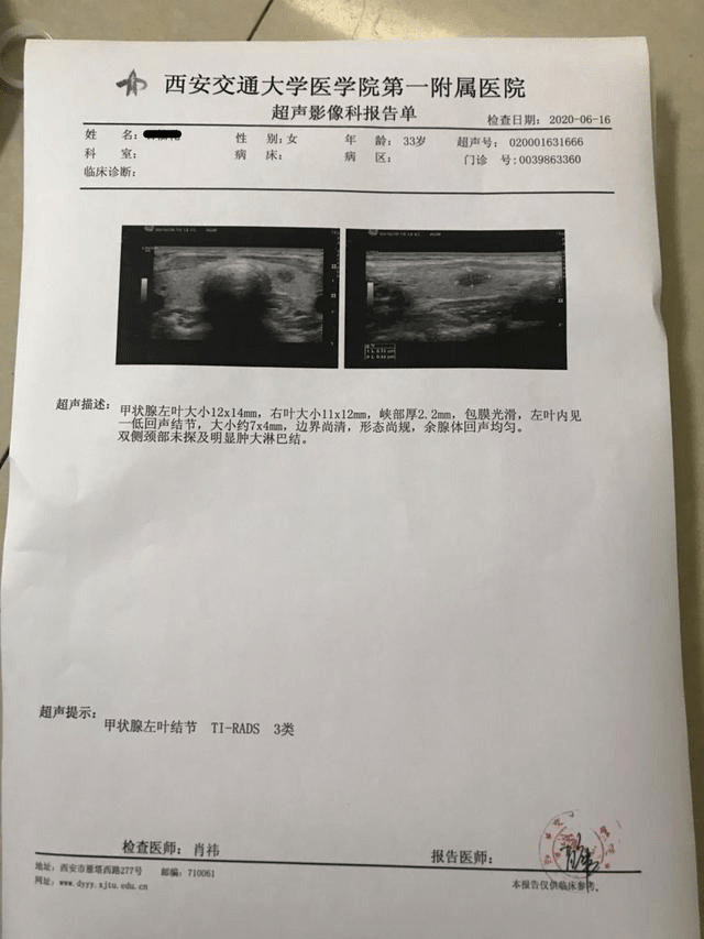 甲状腺结节必须做手术吗?甲状腺结节3级患者自述