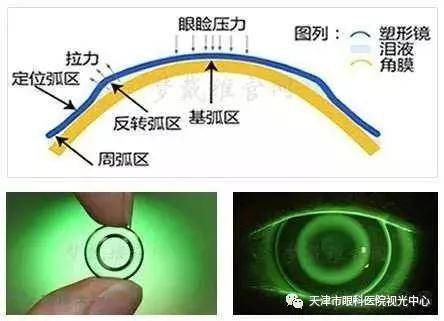 镜子里的镜子无限叫什么原理_无限圈叫什么圈(2)