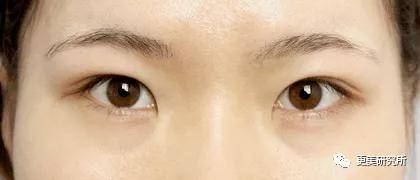 双眼皮|翻了100张照片，才发现她是贵圈换头最失败的女星