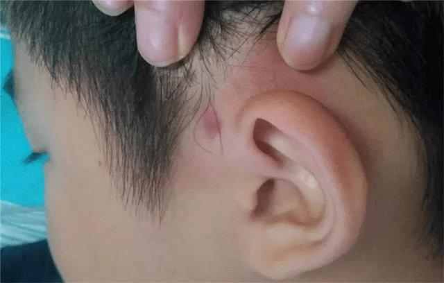 孩子|趁早了解五个实用技能，关键时刻孩子能自救暑假是意外高发期