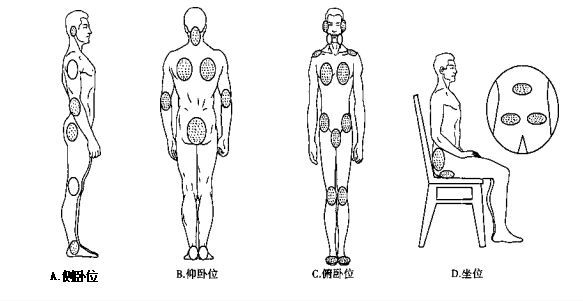 坐位:发生于坐骨结节处.