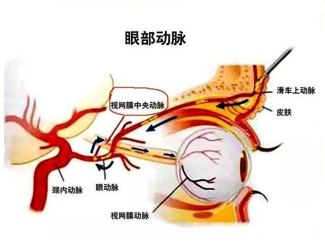 医疗美容再出事:面部脂肪填充,竟然导致失明!