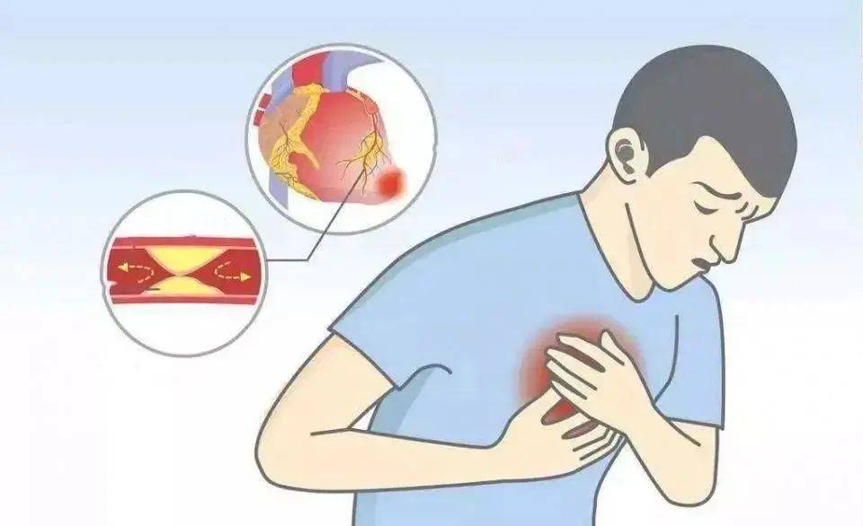 阑尾炎是哪一个地方疼 67a79ce428e240f9947805ba4eea018b.jpeg