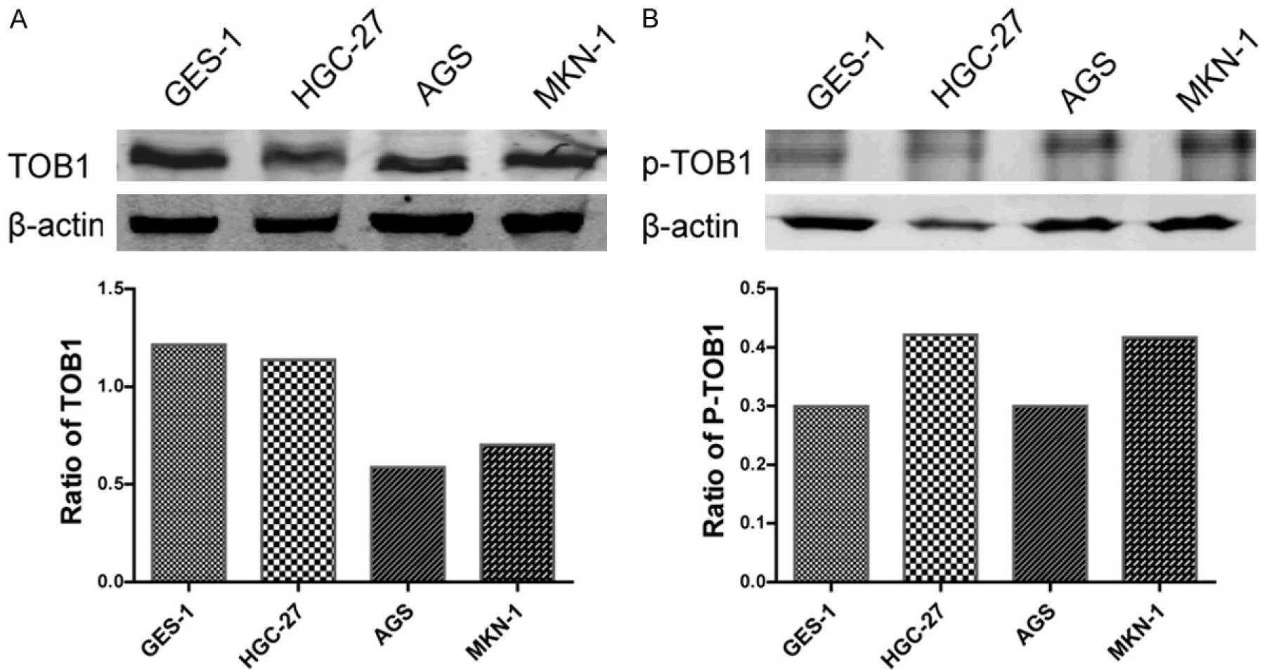 g蛋白结合gdp是被磷酸化吗_蛋白线是蓝色吗(2)