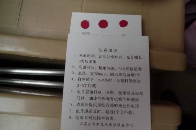 宝宝|这3项新生儿检查很重要，不过关会影响娃智力水平宝宝出生后