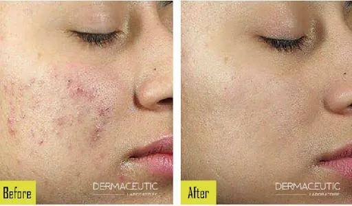 赵丽颖|看了产后赵丽颖的生图，杨幂怕是再也不敢营销自己“少女辣妈”人设了！