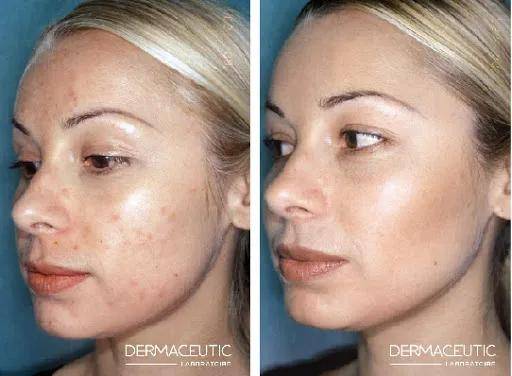 赵丽颖|看了产后赵丽颖的生图，杨幂怕是再也不敢营销自己“少女辣妈”人设了！