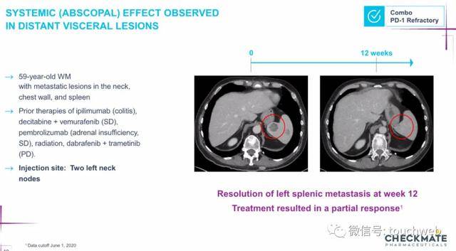 Venture|生物制药公司Checkmate冲刺美股：路演PPT曝光