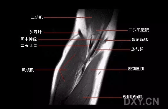 影像解剖: 肘关节mri图谱,超全整理!