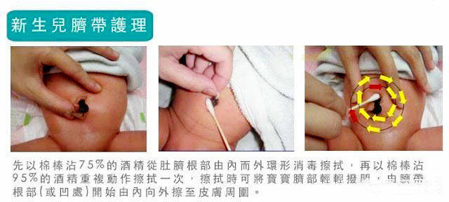 新生儿|这2项新生儿护理马虎不得,不然遭罪的是娃三伏天出生的宝宝