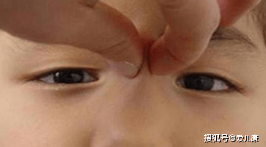 宝宝|有可能是这种病！家长越早发现越好！宝宝看东西喜欢歪头、眯眼并非可爱